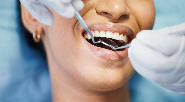 Best Emergency Dental Care for Broken or Chipped Teeth in Woodville, AL